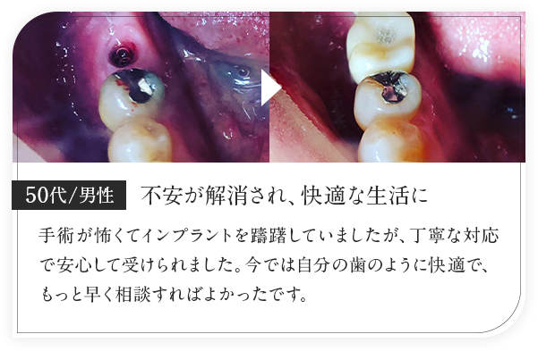 50代男性/不安が解消され、快適な生活に