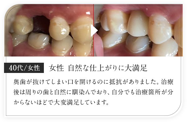 40代女性/自然な仕上がりに大満足