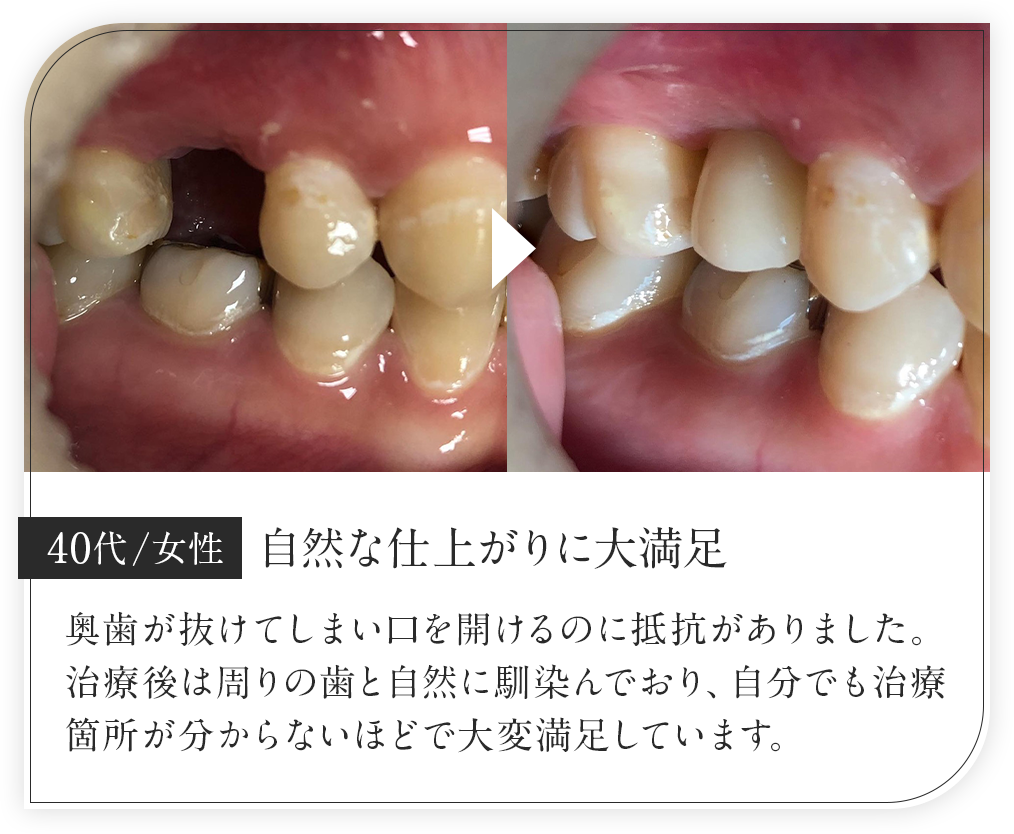 40代女性/自然な仕上がりに大満足