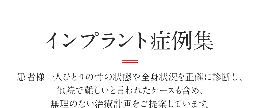 インプラント症例集・患者様一人ひとりの骨の状態や全身状況を正確に診断し、他院で難しいと言われたケースも含め、無理のない治療計画をご提案しています。
